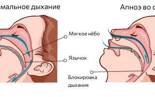 Когда спишь на боку тяжело дышать причины