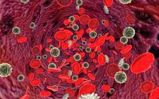 Как бороться с анемией или малокровием?