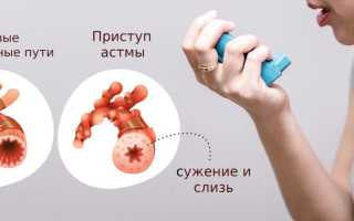 Спазм дыхательных путей симптомы