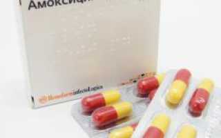 Антибиотики при паратонзиллярном абсцессе