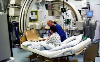 Как делают коронарографию