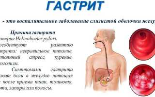 Лечение гастрита желудка народными средствами