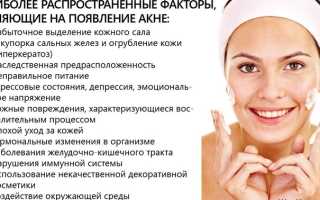 Лечение угревой сыпи на лице