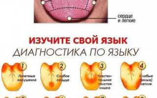 Какие болезни определяют по языку?