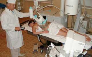 Экстракорпоральная литотрипсия