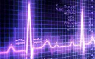 Эос не отклонена