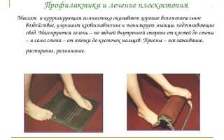 Плоскостопие стопы и его последствия