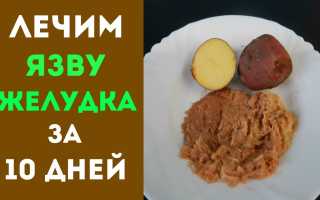 Как лечить язву желудка в домашних условиях?