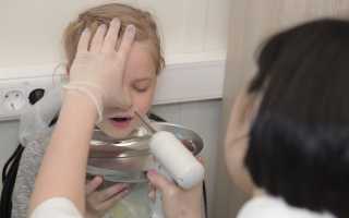 Как лечат аденоиды у детей в носу?