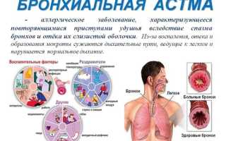 Гиперактивность бронхов у детей