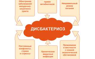 Все о дисбактериозе кишечника