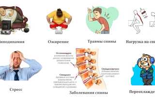 Факторы риска заболеваний суставов и позвоночника