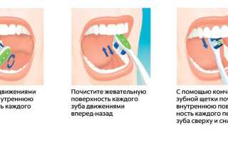 Правильная зубная щетка