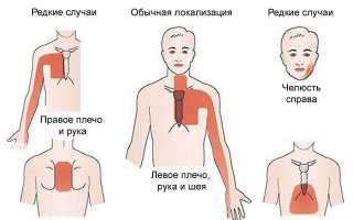 Жжение в сердце
