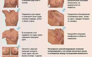 Мастопатия молочной железы симптомы и лечение