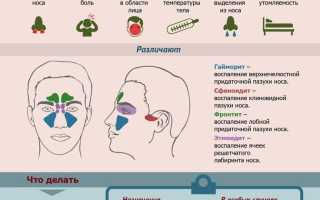 Головная боль при синусите