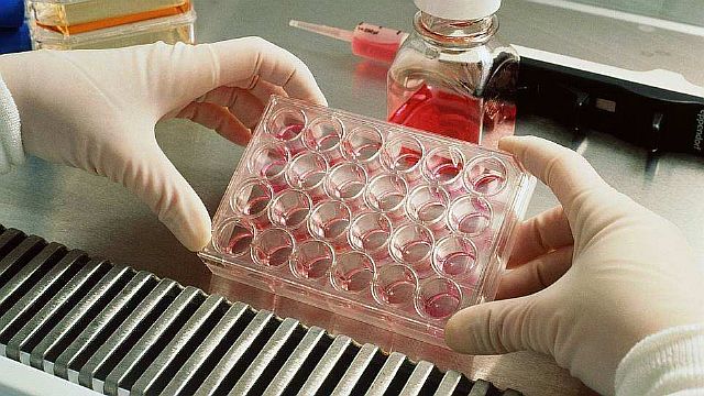 Что за болезнь -  гипатит С