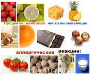 Методы лечения крапивницы