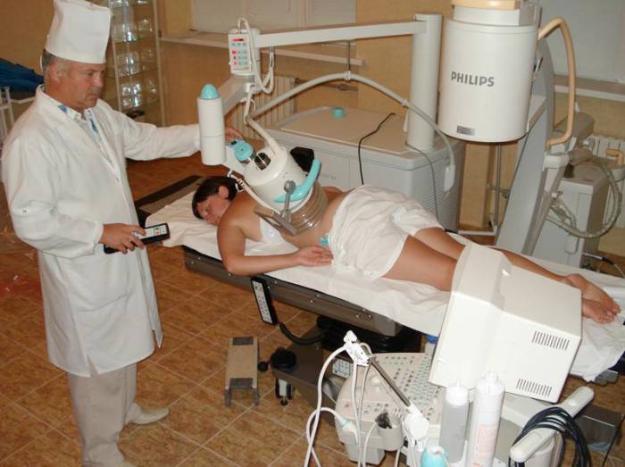 Экстракорпоральная литотрипсия