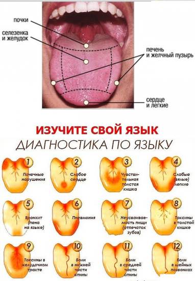 Болезни по языку