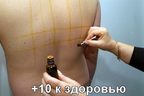 Йодная сетка