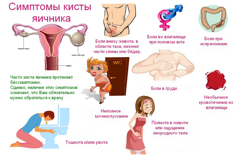 Лечение кисты