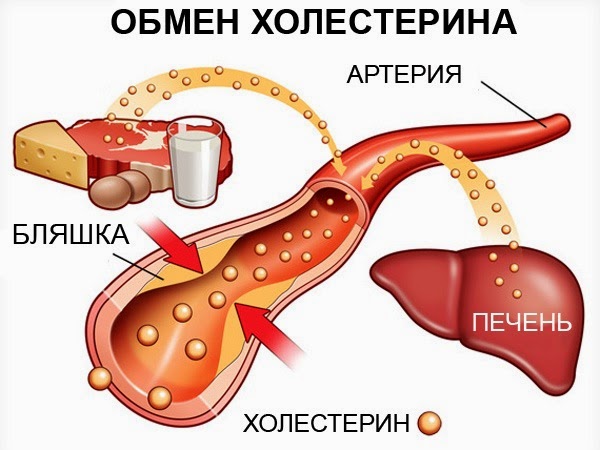 Плохой и хороший холестерин