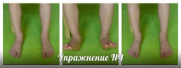 Упражнения при плоскостопии