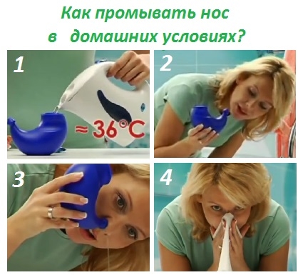 Промывание носа