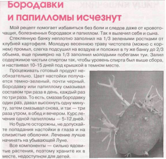 Устранение папиллом