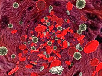 Железодефицитная анемия Железодефицитная анемия